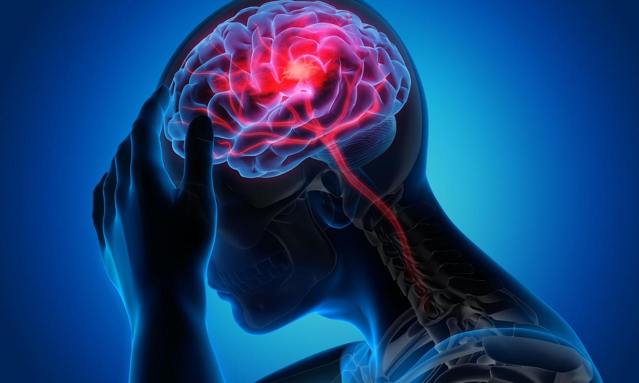 migraines headache emotional or medical